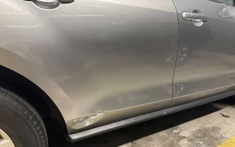 paintless dent repair in queens