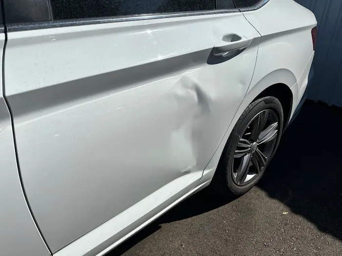 Porras Dent Removal 8