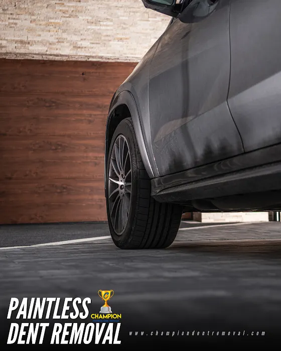 Champion Dent Removal 2