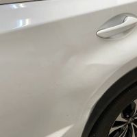 Dents