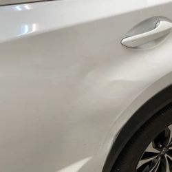 Dents ico